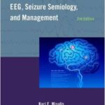 Atlas of EEG, Seizure Semiology, and Management - 2014