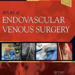 Atlas of Endovascular Venous Surgery - 2019
