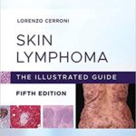 Skin Lymphoma: The Illustrated Guide - 2020