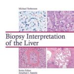 Biopsy Interpretation of the Liver - 2015