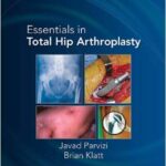 Essentials in Total Hip Arthroplasty - 2013