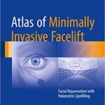 Atlas of Minimally Invasive Facelift: Facial Rejuvenation with Volumetric Lipofilling - 2016