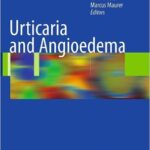 Urticaria and Angioedema - 2010