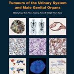 WHO Classification of Tumours of the Central Nervous System - 2016