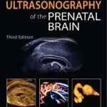 Ultrasonography of the Prenatal Brain - 2012