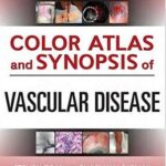 Color Atlas and Synopsis of Vascular Disease - 2014