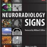 Neuroradiology Signs - 2014