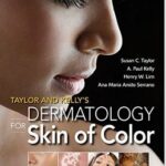 Dermatology for Skin of Color - Taylor and Kelly`s - 2016