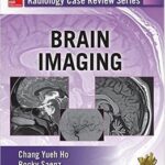 Radiology Case Review Series: Brain Imaging - 2015