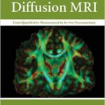 Diffusion MRI: From Quantitative Measurement to In vivo Neuroanatomy - 2014