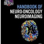 Handbook of Neuro-Oncology Neuroimaging - 2016