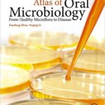 Atlas of Oral Microbiology: From Healthy Microflora to Disease - 2015
