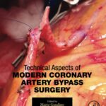 Technical Aspects of Modern Coronary Artery Bypass Surgery - 2021