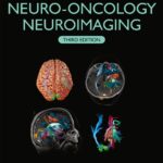 Handbook of Neuro-Oncology Neuroimaging - 2022