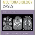 Neuroradiology Cases (Cases in Radiology) - 2012