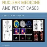 Nuclear Medicine and PET/CT Cases (Cases in Radiology) - 2015