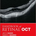 Handbook of Retinal OCT: Optical Coherence Tomography - 2014