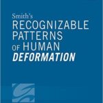 Recognizable Patterns of Human Deformation-Smith`s - 2016