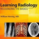 Learning Radiology: Recognizing the Basics - 2016