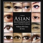 Asian Blepharoplasty and the Eyelid Crease - 2016