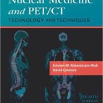 Nuclear Medicine and PET/CT: Technology and Techniques - 2017