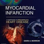 Myocardial Infarction: A Companion to Braunwald`s Heart Disease - 2017