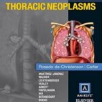 Specialty Imaging: Thoracic Neoplasms - 2016