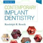 Contemporary Implant Dentistry Misch`s - 2021