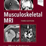 Musculoskeletal MRI - 2020