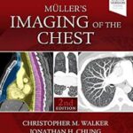 Imaging of the Chest: Expert Radiology Series Muller`s - 2019
