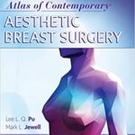 Atlas of Contemporary Aesthetic Breast Surgery A Comprehensive Approach - 2021