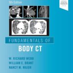 Fundamentals of Body CT (Fundamentals of Radiology) - 2019