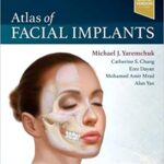 Atlas of Facial Implants - 2020