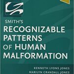 Recognizable Patterns of Human Malformation Smith`s - 2022