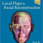 Local Flaps in Facial Reconstruction Baker - 2022