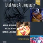 The Technique of Total Knee Arthroplasty - 2023