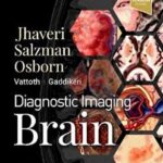 Diagnostic Imaging: Brain Osborn - 2021