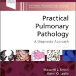 Practical Pulmonary Pathology: A Diagnostic Approach - 2024