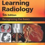 Learning Radiology: Recognizing the Basics - 2024