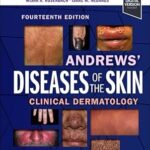 Diseases of the Skin: Clinical Dermatology Andrews - 2025