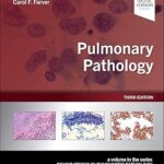 Pulmonary Pathology (Foundations in Diagnostic Pathology) - 2025