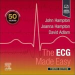 The ECG Made Easy - 2025