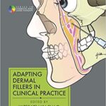 Adapting Dermal Fillers in Clinical Practice - 2022