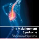 The Malalignment Syndrome: diagnosis and treatment of common pelvic and back pain - 2013