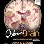 Osborn`s Brain - 2024