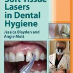 Soft-Tissue Lasers in Dental Hygiene - 2013