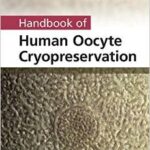 Handbook of Human Oocyte Cryopreservation - 2013