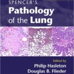 Pathology of the Lung-2Vol - Spencer`s - 2013