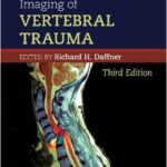Imaging of Vertebral Trauma - 2011