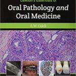Essentials of Oral Pathology and Oral Medicine Cawson`s - 2017